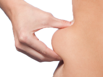 CoolSculpting image of woman squeezing her side
